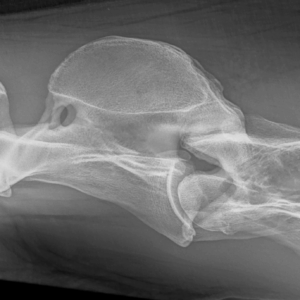 Radiografie van de hals