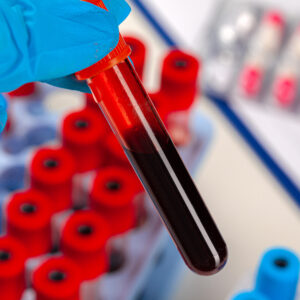 Het belang van serologie en PCR in de diagnostiek van veel voorkomende aandoeningen