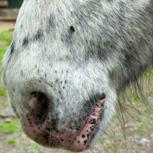 Sinusitis